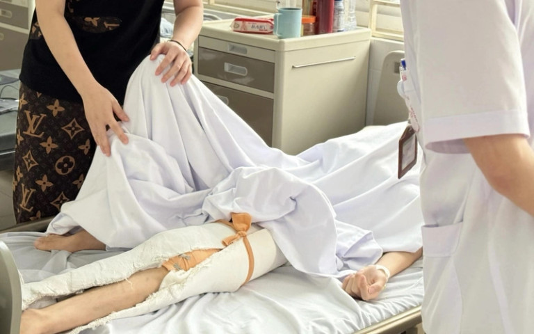 Điều trị cho thanh niên 15 tuổi mắc viêm xương tủy do tụ cầu vàng