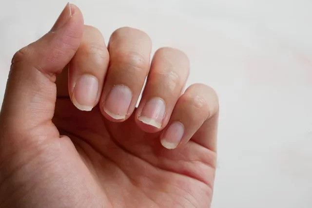 8 mẹo đơn giản giúp móng tay chắc khỏe hơn