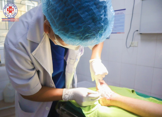 Nghệ An: Điều trị thành công cho bé trai 10 tuổi bị tai nạn giao thông gãy xương gót, xương bàn chân