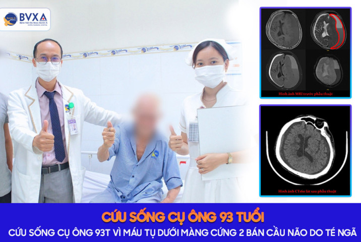 Long An: Phẫu thuật cho cụ ông 93 tuổi bị máu tụ dưới màng cứng do tai nạn sinh hoạt