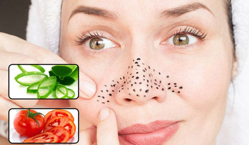 Cách trị mụn đầu đen tại nhà bằng nguyên liệu tự nhiên