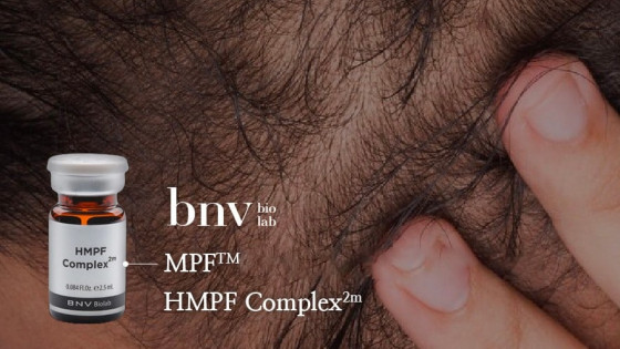 HMPF giúp cải thiện vấn đề rụng tóc và tăng cường sức khỏe của nang tóc