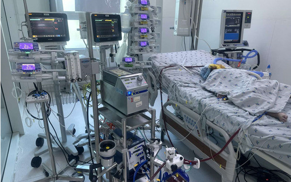 TP. Hồ Chí Minh: Can thiệp ECMO cứu sống 1 trường hợp bé gái 3 tuổi viêm phổi do cúm A/H1 biến chứng suy hô hấp nặng