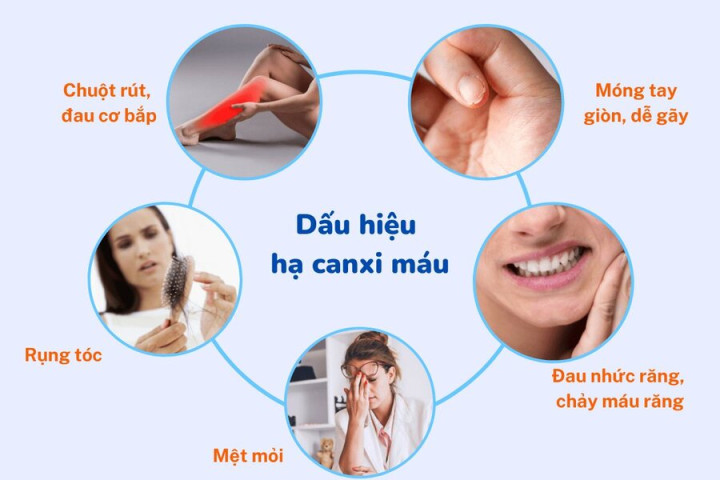 Tìm hiểu về bệnh lý tụt canxi
