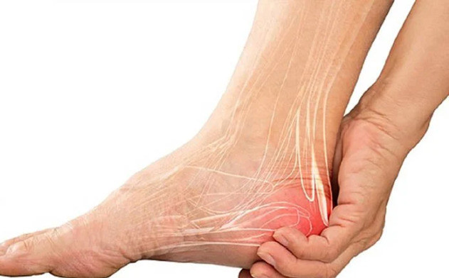 Nguyên nhân gây ra tình trạng viêm cân gan bàn chân
