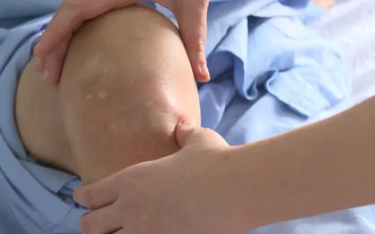 Thái Bình: Cảnh báo tự ý điều trị các bệnh xương khớp dẫn đến tai biến nguy hiểm