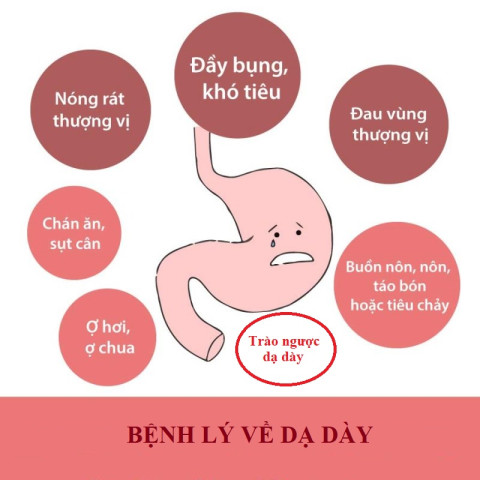 Hiểu về bệnh đau dạ dày và trào ngược dạ dày