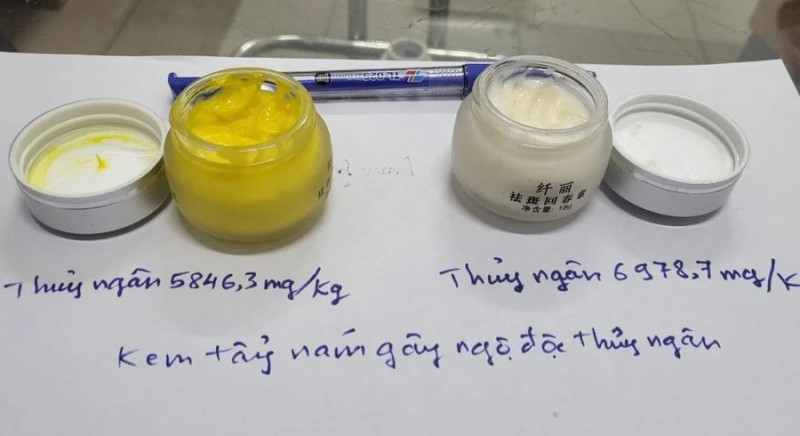 Cảnh báo nhiều trường hợp bị ngộ độc thủy ngân do dùng mỹ phẩm không rõ nguồn gốc để trị nám