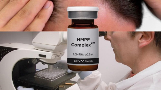 Phát hiện bước tiến mới trong điều trị rụng tóc