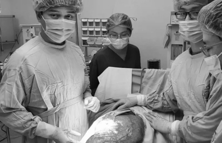 Phẫu thuật loại bỏ khối u mô mềm ổ bụng nặng hơn 8 kg cho nam thanh niên 23 tuổi