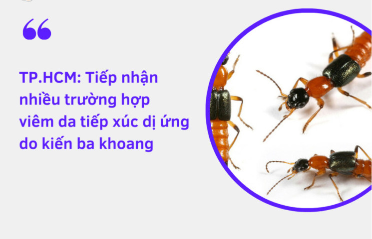 TP. Hồ Chí Minh: Tiếp nhận nhiều trường hợp viêm da tiếp xúc dị ứng do kiến ba khoang