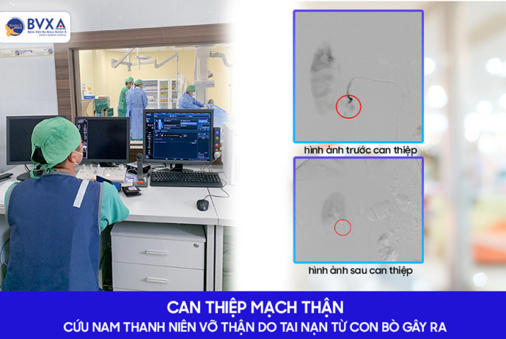 Tây Ninh: Cấp cứu nam thanh niên 24 tuổi bị chấn thương trong khi lao động