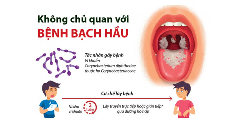 Chuyên gia khuyến cáo cách phòng tránh bệnh bạch hầu