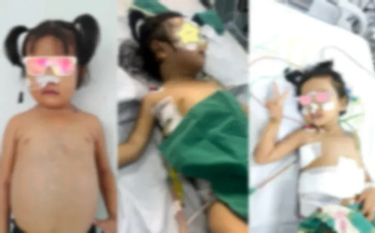 TP. Hồ Chí Minh  thực hiện thành công ca ghép gan đặc biệt cho bé gái mắc hội chứng Budd Chiari