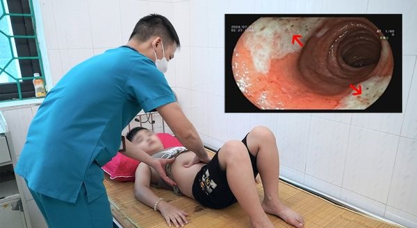Phú Thọ: Cấp cứu bé trai 9 tuổi bị loét hành tá tràng do sử dụng thuốc không đúng