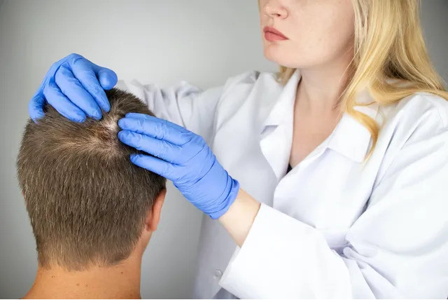 Triệu chứng, nguyên nhân và cách điều trị bệnh nấm da đầu