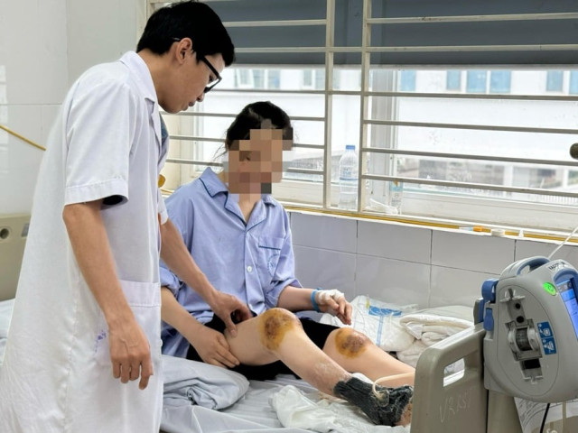 Điều trị cho người phụ nữ bị hoại tử chân do dùng ong đốt chữa bệnh