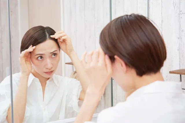 Triệu chứng, nguyên nhân và cách điều trị hói đầu ở phụ nữ