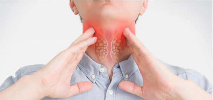 Dấu hiệu bất thường ở cổ có thể là triệu chứng ung thư
