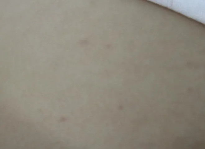 Quảng Nam: Cấp cứu bé 3 tháng tuổi bị xuất huyết giảm tiểu cầu miễn dịch