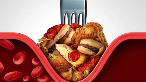 4 dấu hiệu cảnh báo cholesterol cao