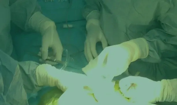 TP Hồ Chí Minh: Phẫu thuật giải phóng 1,5 lít nước cho bé gái 5 tháng tuổi mắc bệnh thận ứ nước
