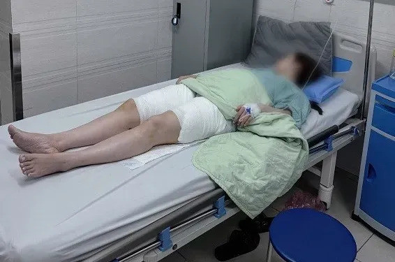 Nhiều người bị di chứng sau phẫu thuật thẩm mỹ tại cơ sở kém chất lượng