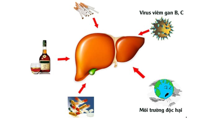 Vì sao nóng gan ngày càng nhiều và các món ăn bổ gan là gì?