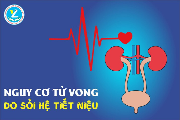 Phú Thọ: Cấp cứu bệnh nhân 45 tuổi bị sốc nhiễm khuẩn do sỏi đường tiết niệu biến chứng