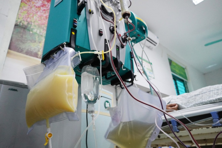 Phú Thọ: Cấp cứu người đàn ông có huyết tương trắng đục như sữa do viêm tuỵ cấp