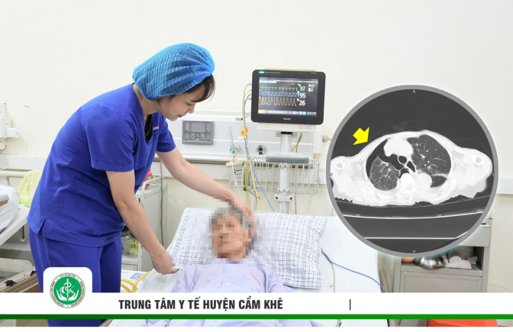 Phú Thọ: Cấp cứu thành công cụ bà 99 tuổi trụy tim mạch, xẹp phổi