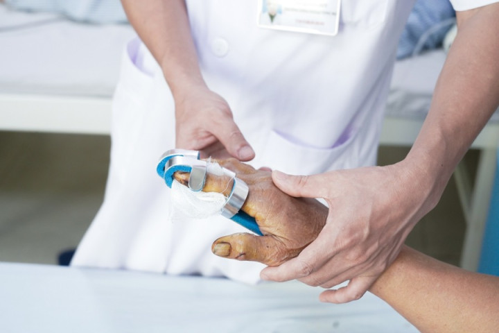 Phú Thọ: Cấp cứu người bệnh bị chấn thương nặng bàn tay khi đang sạc thì điện thoại bất ngờ phát nổ