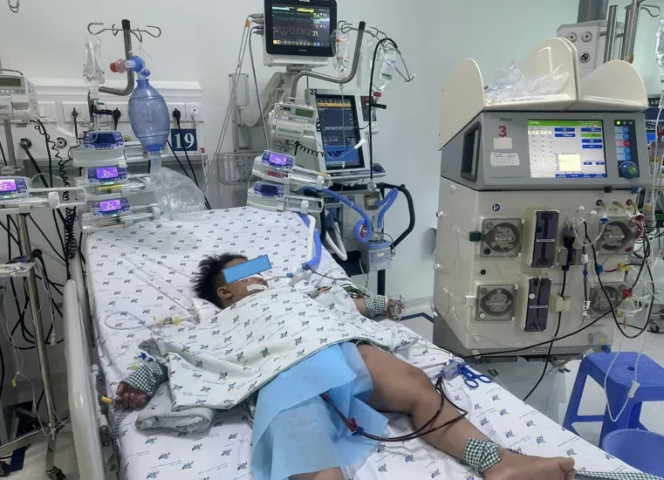 TP. Hồ Chí Minh: Cấp cứu bé trai nguy kịch vì sốc nhiễm trùng, tổn thương đa cơ quan
