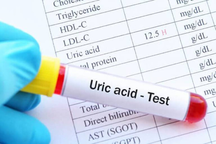Mẹo kiểm soát nồng độ axit uric trước khi đi ngủ
