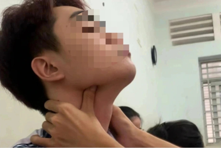 Trào lưu "bắt pen" gây nguy hiểm
