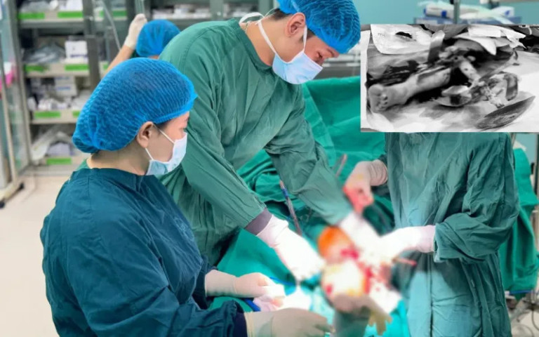 Hà Nội: Phẫu thuật cấp cứu nam bệnh nhân bị lưỡi bừa cắt và găm sâu vào cẳng chân trái