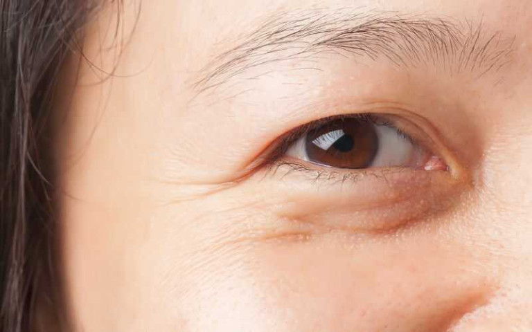 Mẹo giúp ngăn ngừa lão hóa mắt