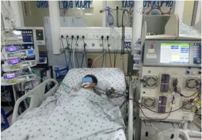 TP. Hồ Chí Minh: Cứu sống một bệnh nhi 4 tuổi bị sốc sốt xuất huyết nặng, biến chứng suy đa cơ quan