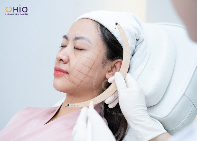 Reborn Lift – Phương pháp trẻ hóa đa điểm giúp căn chỉnh gương mặt theo chuẩn tỷ lệ vàng