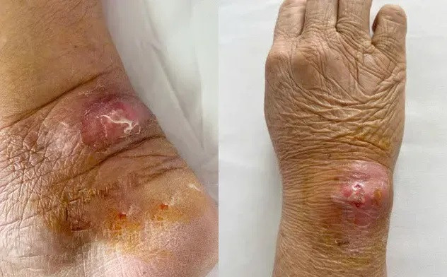 Quảng Ninh: Nhiều trường hợp nhập viện với vết thương do mèo cào, cắn