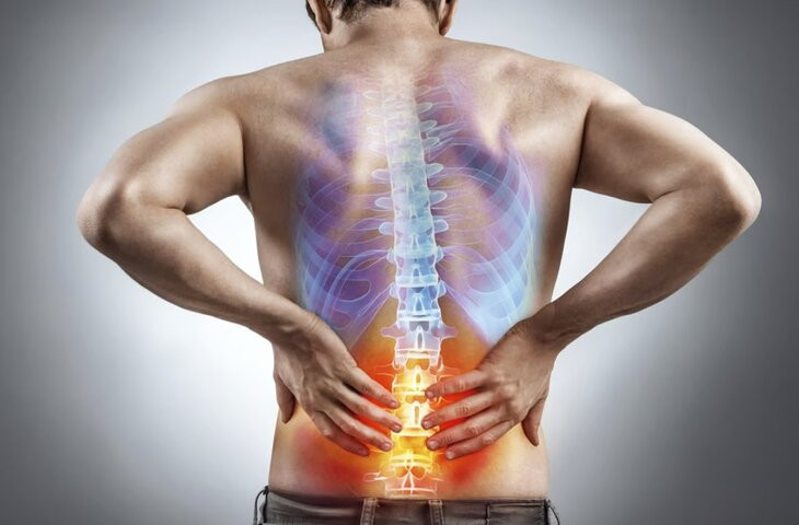 Tư thế đứng dễ gây đau thần kinh tọa, vẹo cột sống