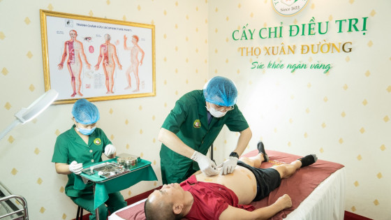 Cấy chỉ hỗ trợ điều trị động kinh