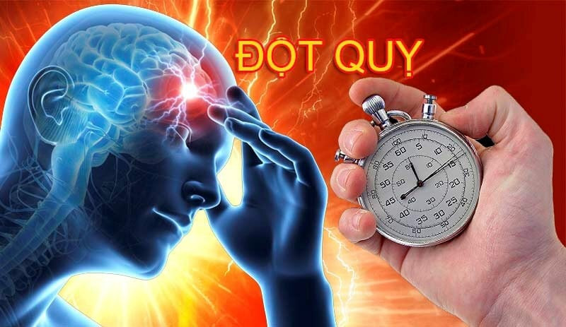 Quảng Ninh: Điều trị cho bệnh nhân 71 tuổi bị đột quỵ với triệu chứng thiếu máu não