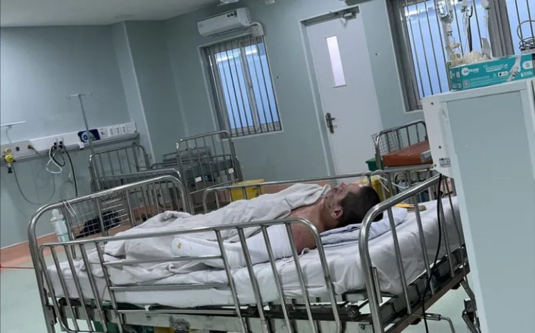 TP. Hồ Chí Minh: Phẫu thuật cấp cứu bệnh nhi 12 tuổi bị dập nát bàn tay do pháo nổ