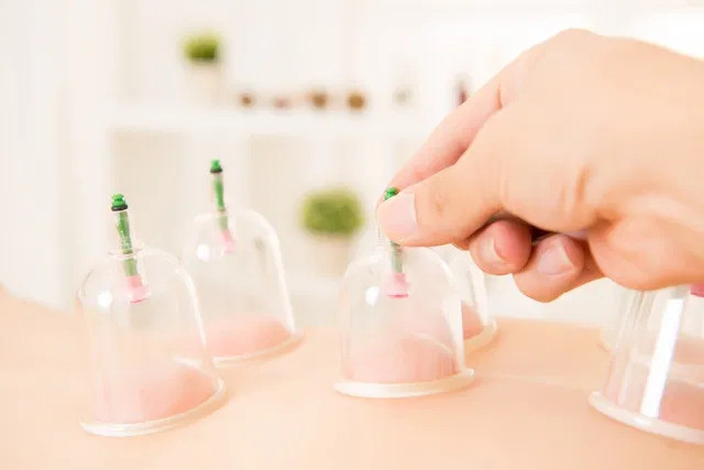 Lợi ích của liệu pháp giác hơi