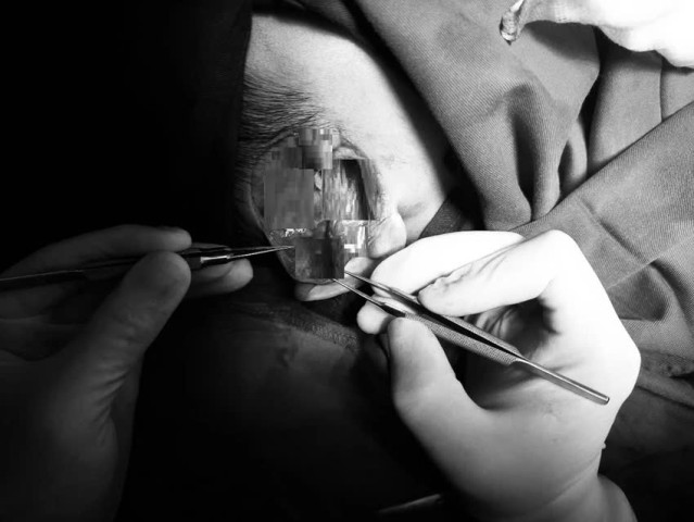 Hà Nội: Bé trai 8 tuổi suýt đứt rời tai do bị chó nhà cắn