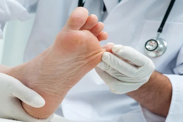 Triệu chứng và cách điều trị nấm chân