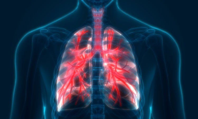 Bài thuốc hỗ trợ phổi tắc nghẽn, viêm phế quản mãn tính