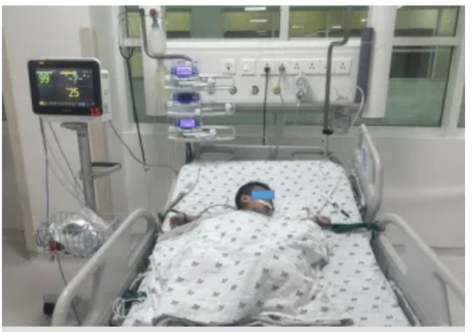 TP. Hồ Chí Minh: Phẫu thuật cho bệnh nhi 1 tuổi bị vỡ khí quản hiếm gặp sau khi ngã