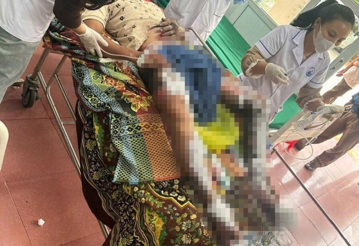 Nghệ An: Người đàn ông bị bỏng nặng nghi do điện thoại phát nổ khi sạc